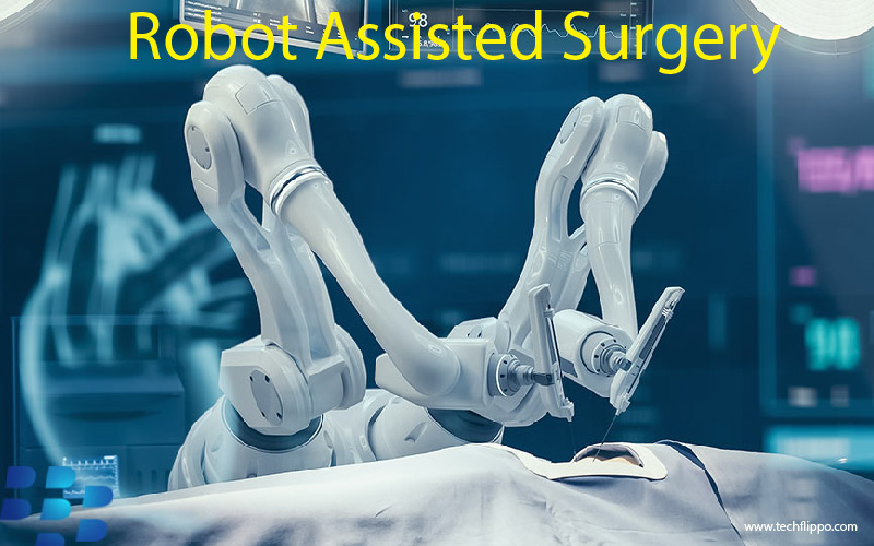 Robot Assisted Surgery